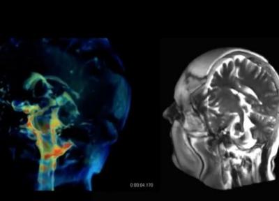 فناوری جدیدی برای تصویربرداری 3 بعدی از مغز